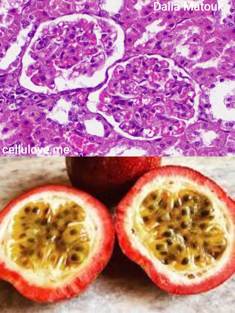 The Glomerular Passion