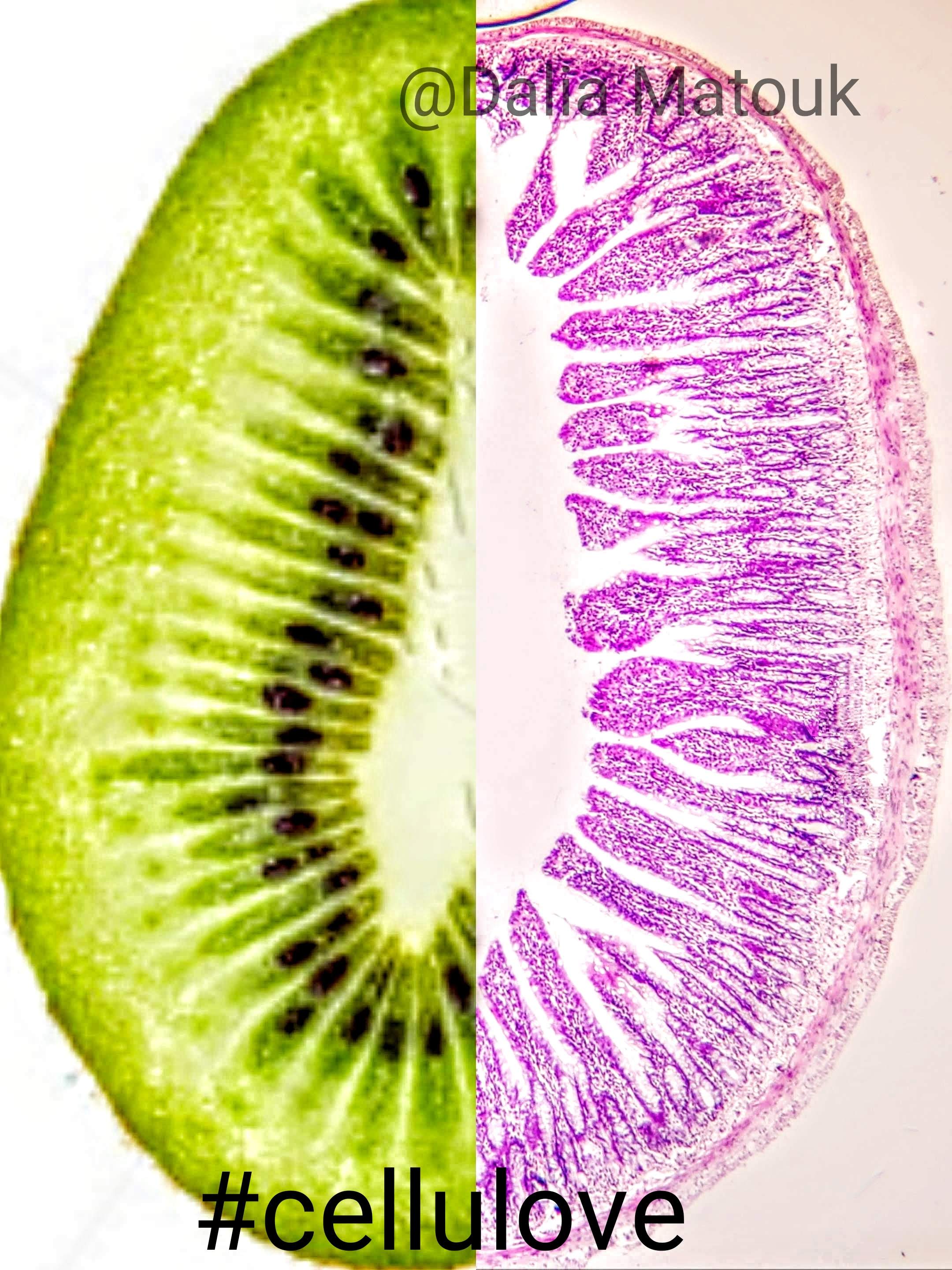 kiwi jejunum