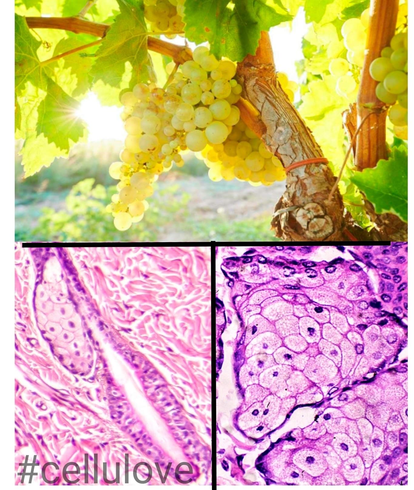 sebaceous grapes