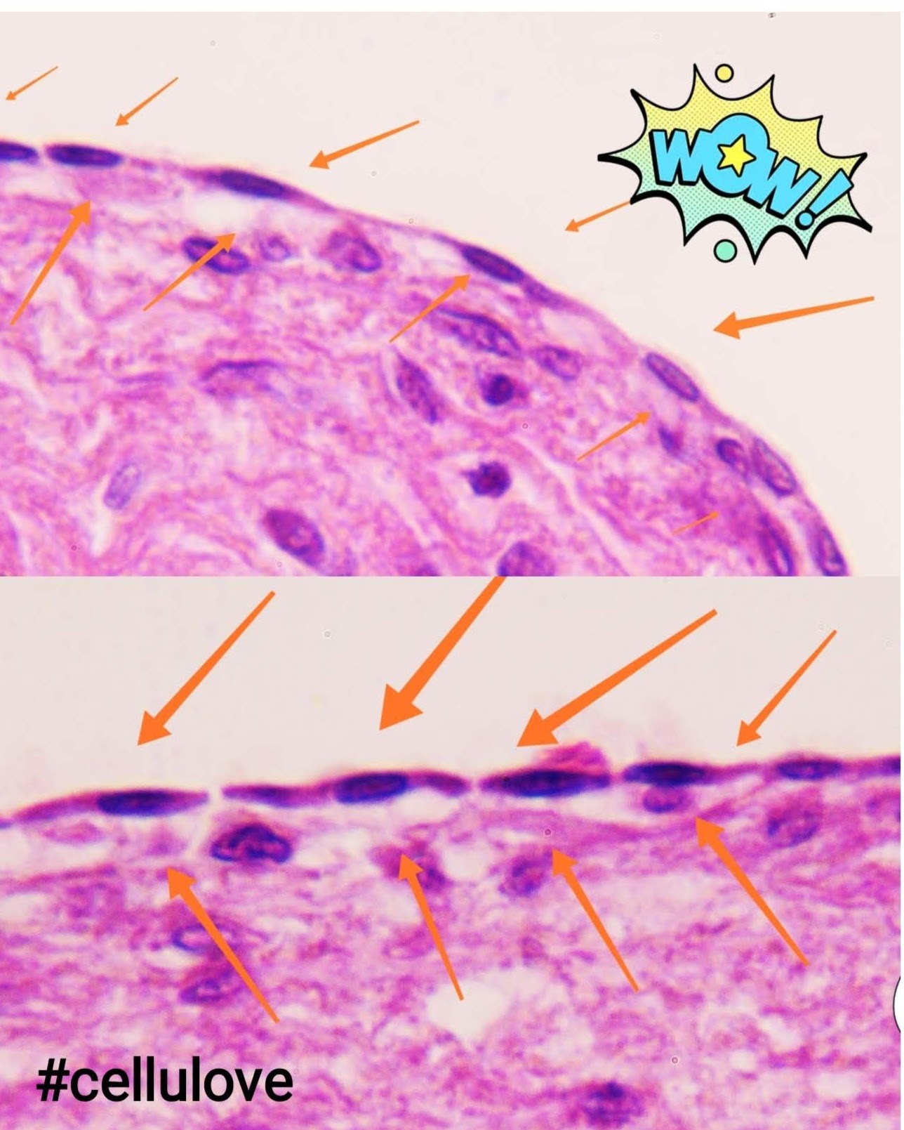 simple squamous