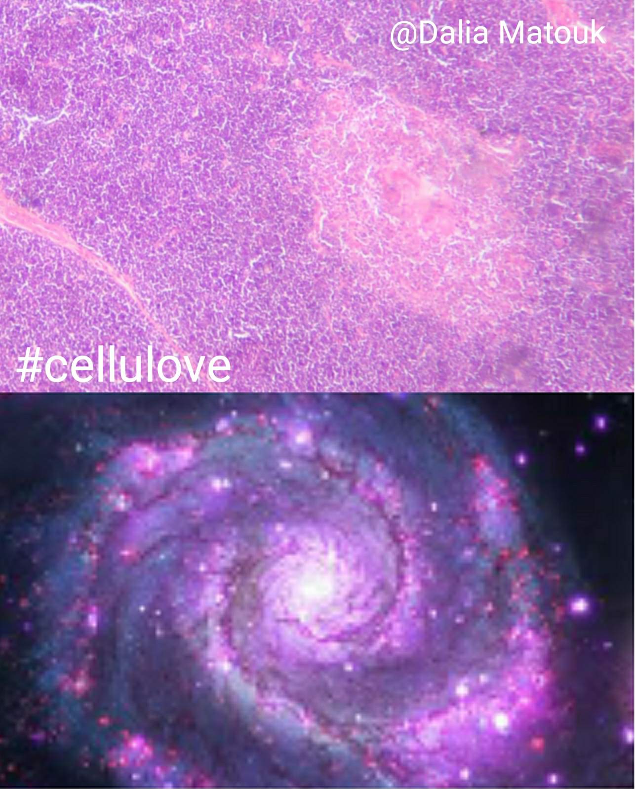 thymic galaxy